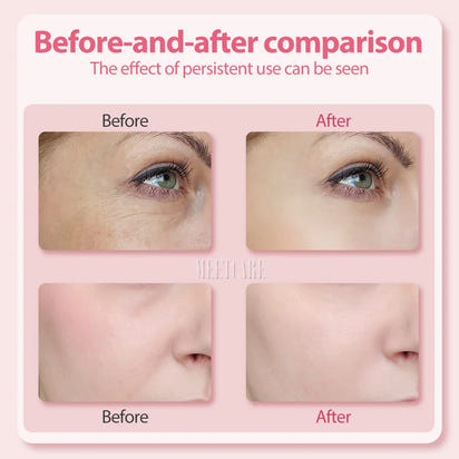 Rejuvenating Facial Massage Wand™