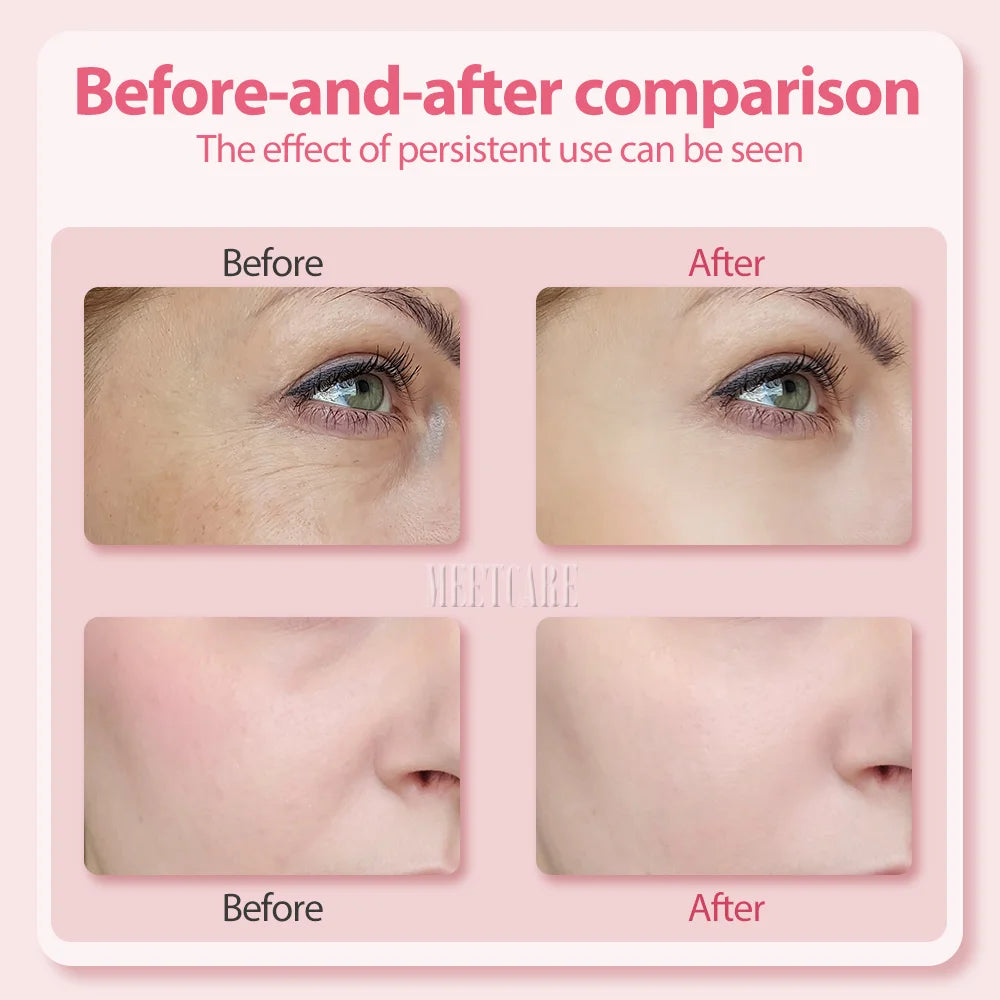 Rejuvenating Facial Massage Wand™