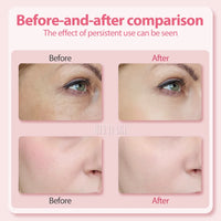 Rejuvenating Facial Massage Wand™